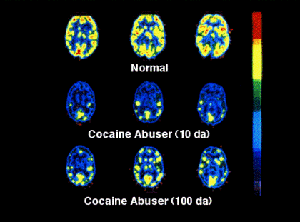 cocaine effect